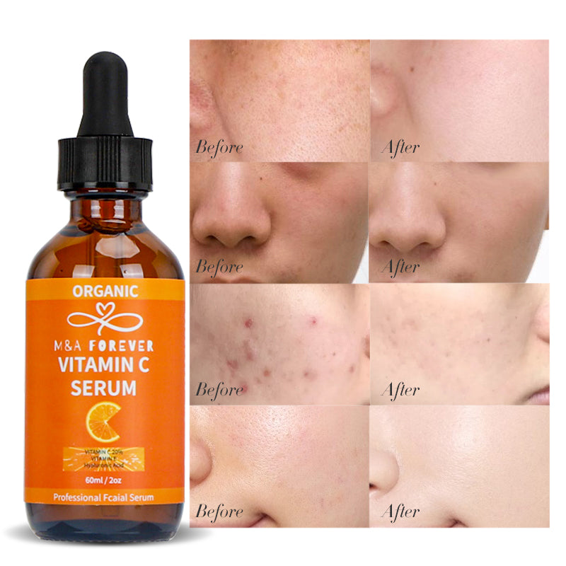 Organic Vitamin C Serum